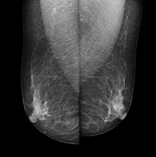 MX-600 · Clinical images 4